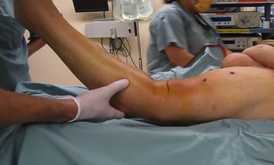 Knee dislocation examination